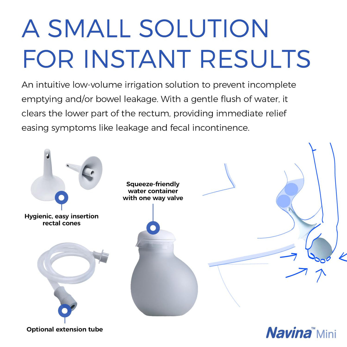 Low-Volume Enema Irrigation System with Water Bulb, Extension Tube, and 5 Rectal Cones U81822