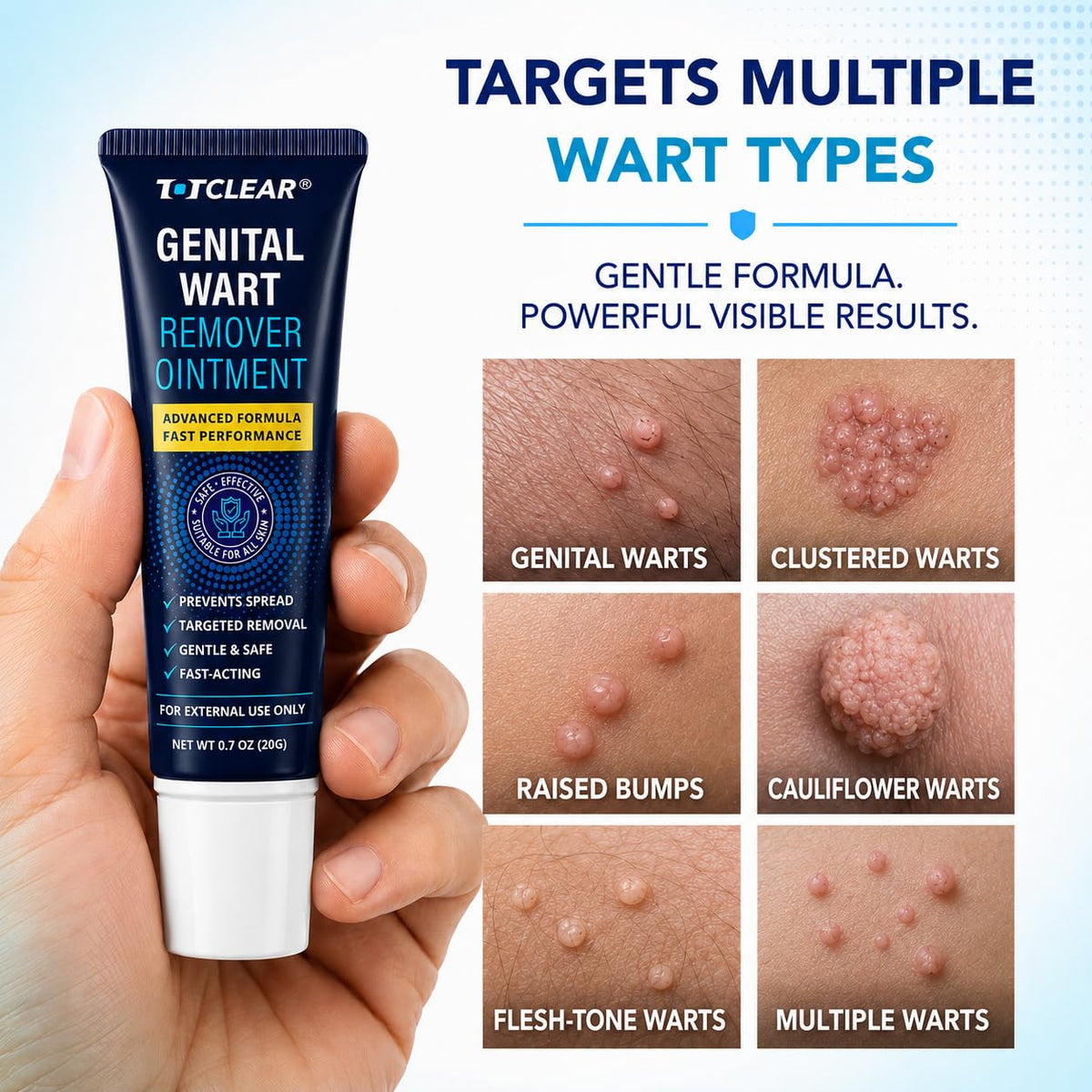 Salicylic Acid Wart Remover Cream 0.7 oz G464